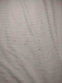 The sheets when we checked the bed after I woke up to my toe, arm, and ankle burning.