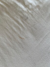 Manchas en los blancos de la cama y almohadas.