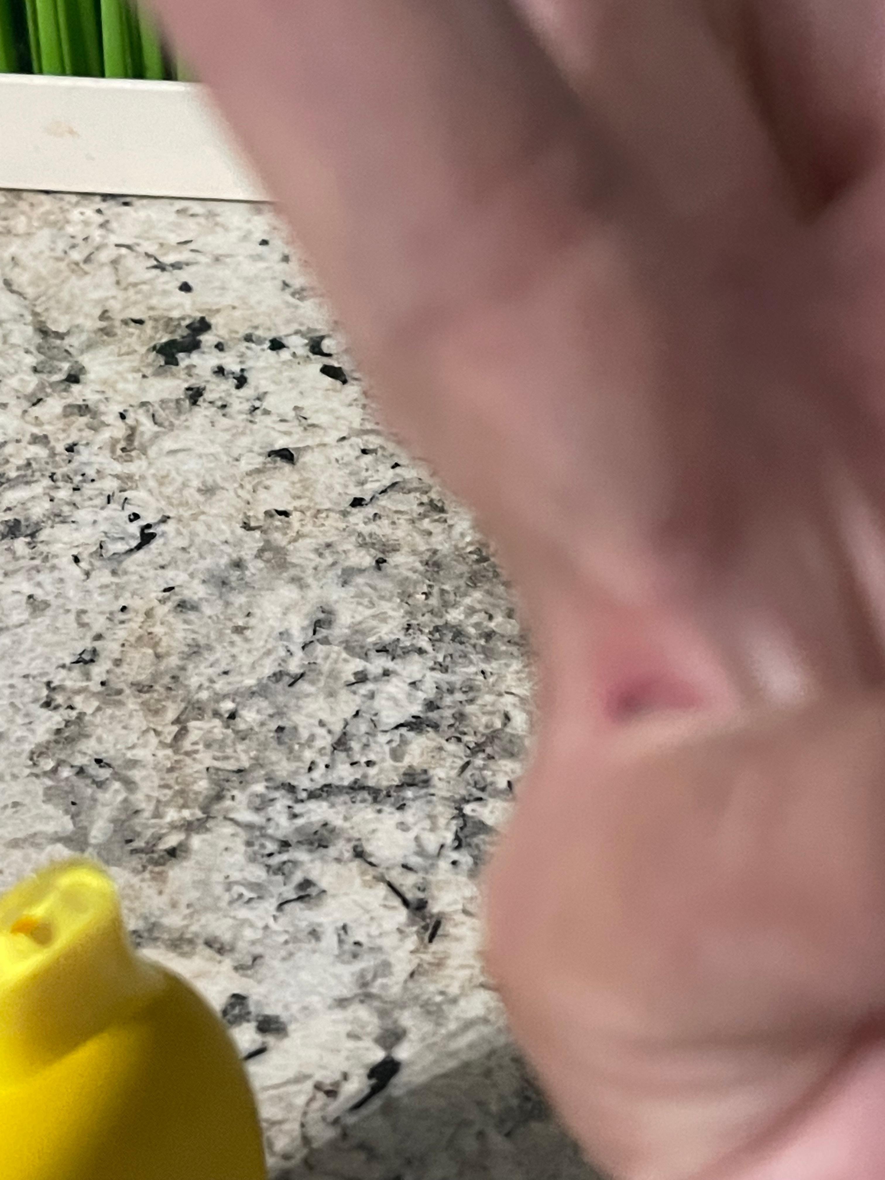 Finger cut from
Fall