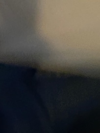 Bloody snot on the pillows and sheets.