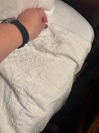 Stains on the bedding