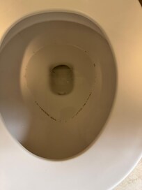 Black ring in toilet