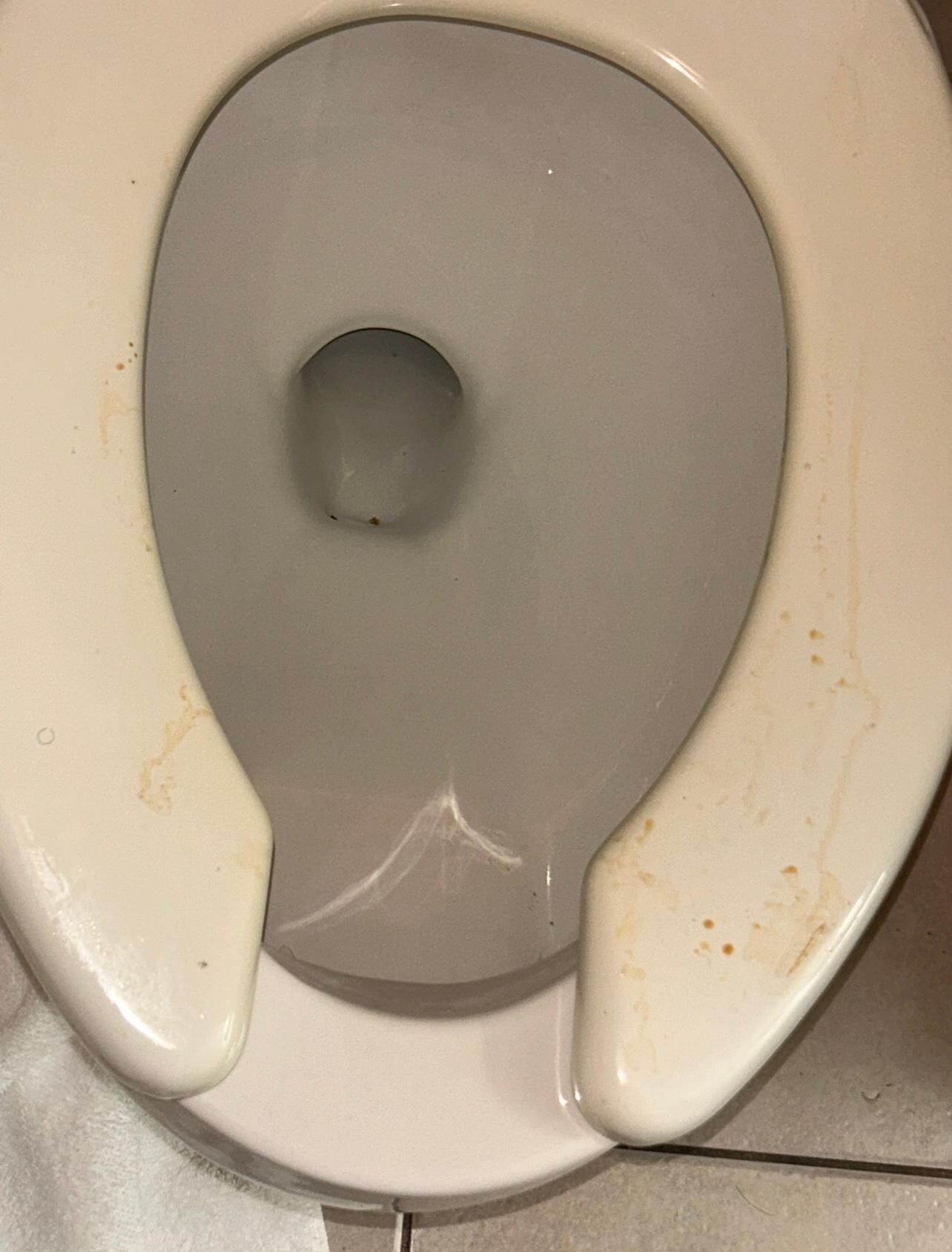 Dirty toilet 