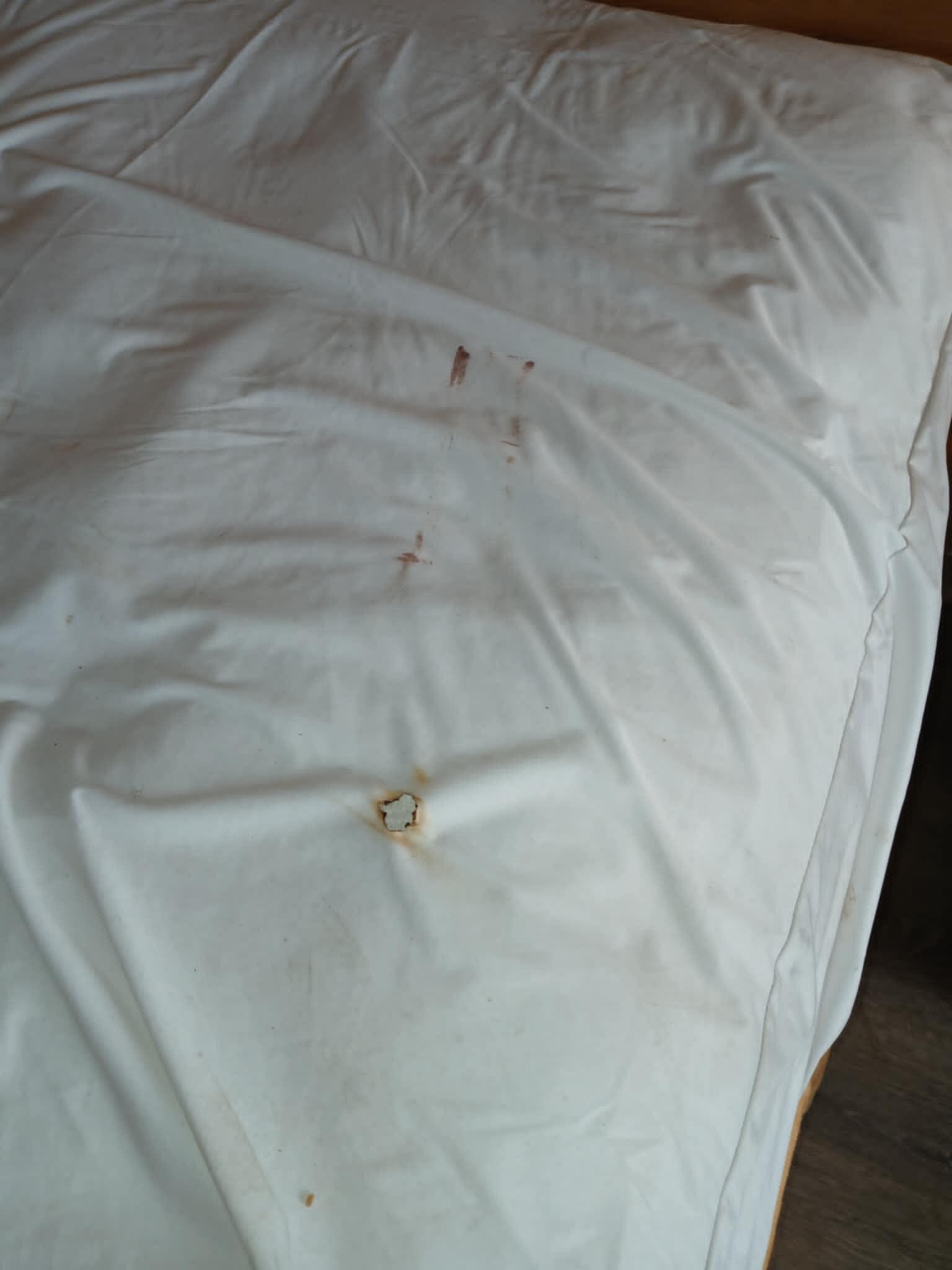 Burn hole and blood spots on mattress cover.