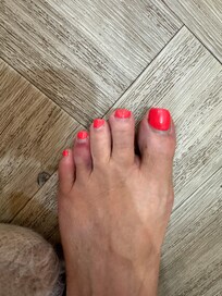 Broken toe
