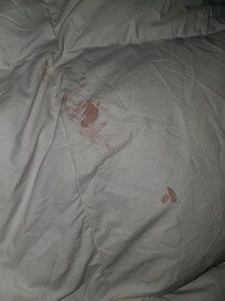 Blood stains