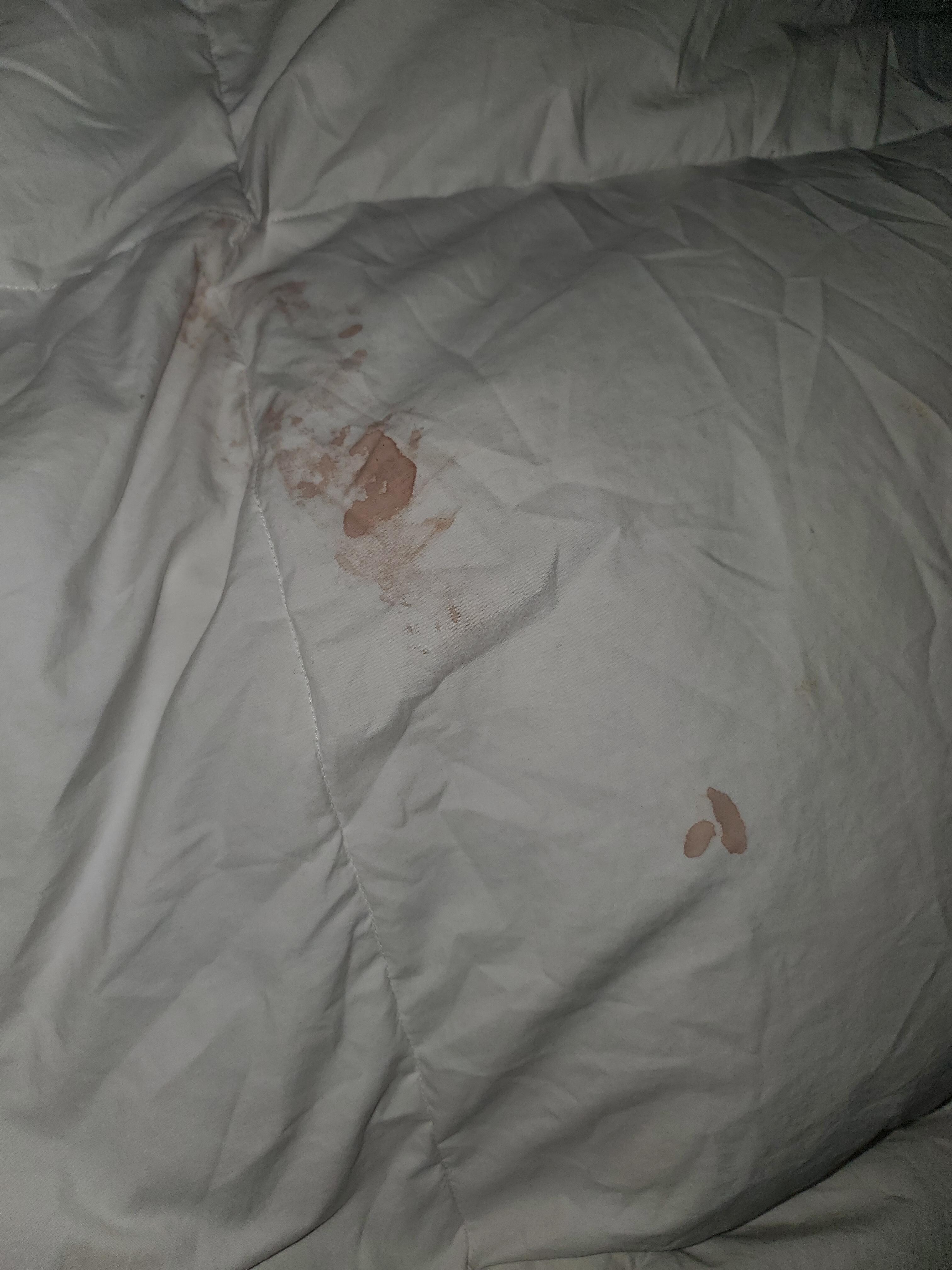 Blood stains