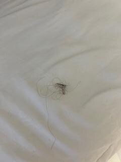 Hair found in all of our beds. 