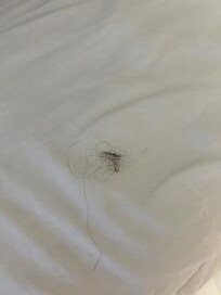 Hair found in all of our beds.