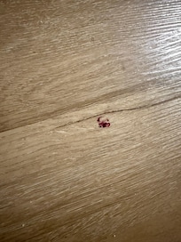 What seem to be a blood stain