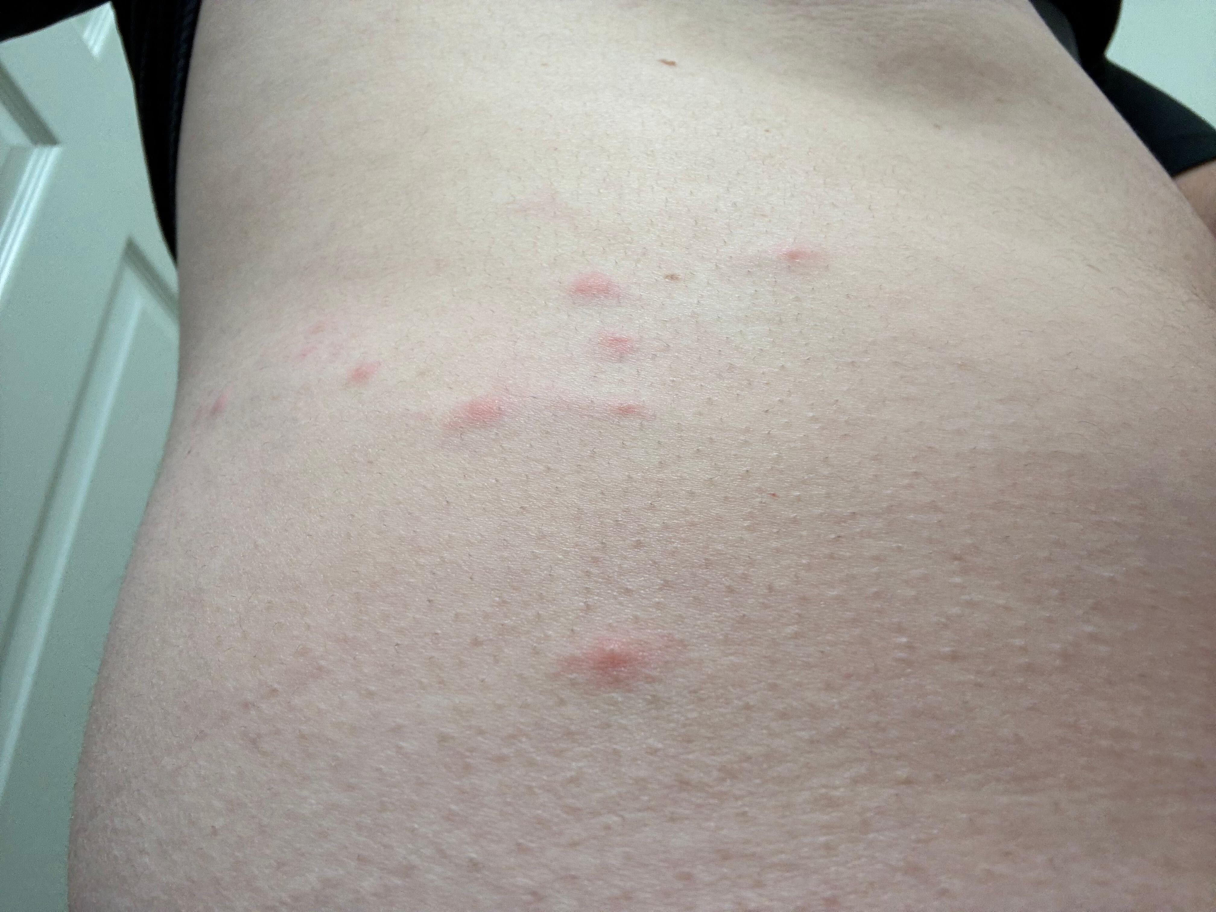 Bed bugs… NOT A CLEAN LOCATION 