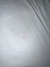 Staining on fitted sheet