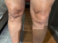 You notice the swollen left knee. Accident waiting to happen at this property
