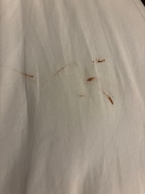 Dried up bloody sheets made up on the bed