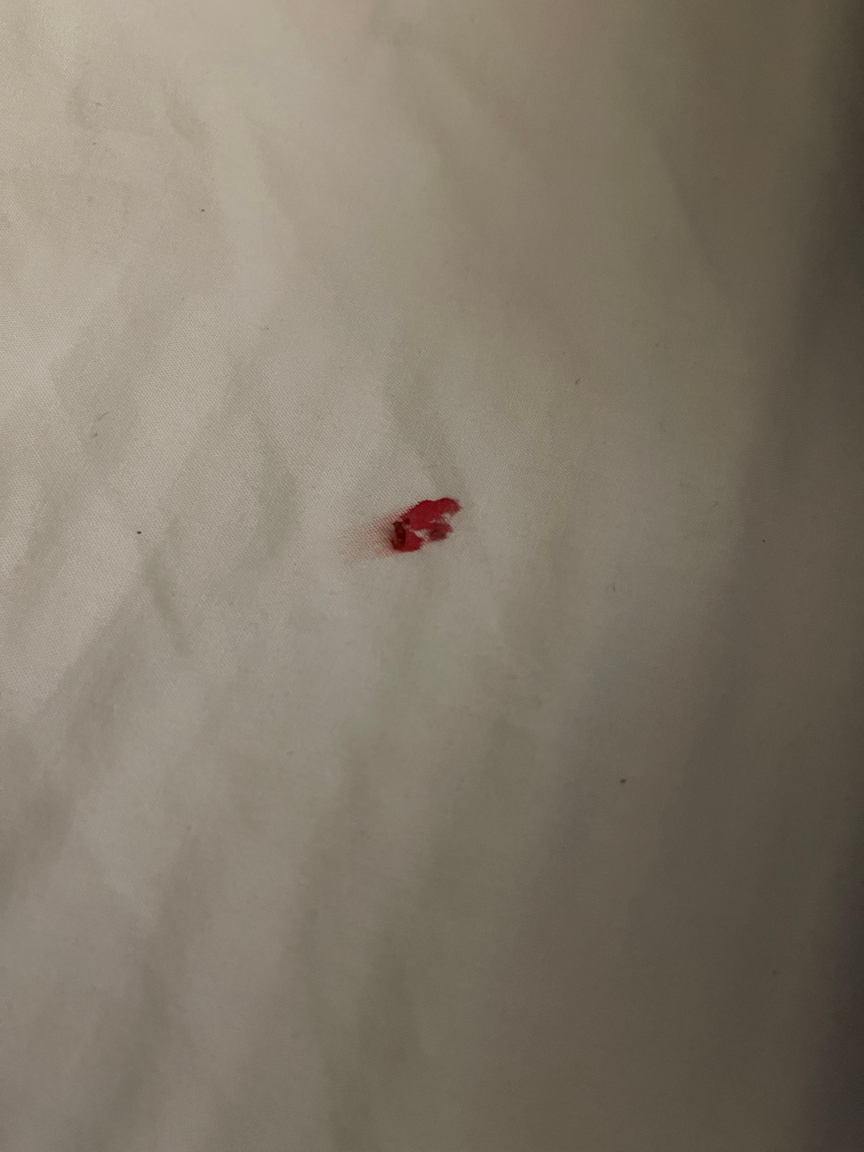 That was the bedbug bloody stain on my bed.