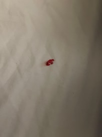 That was the bedbug bloody stain on my bed.