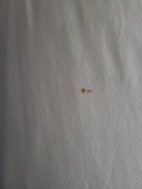 Blood stain on sheet