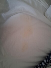 Stains on top sheet.