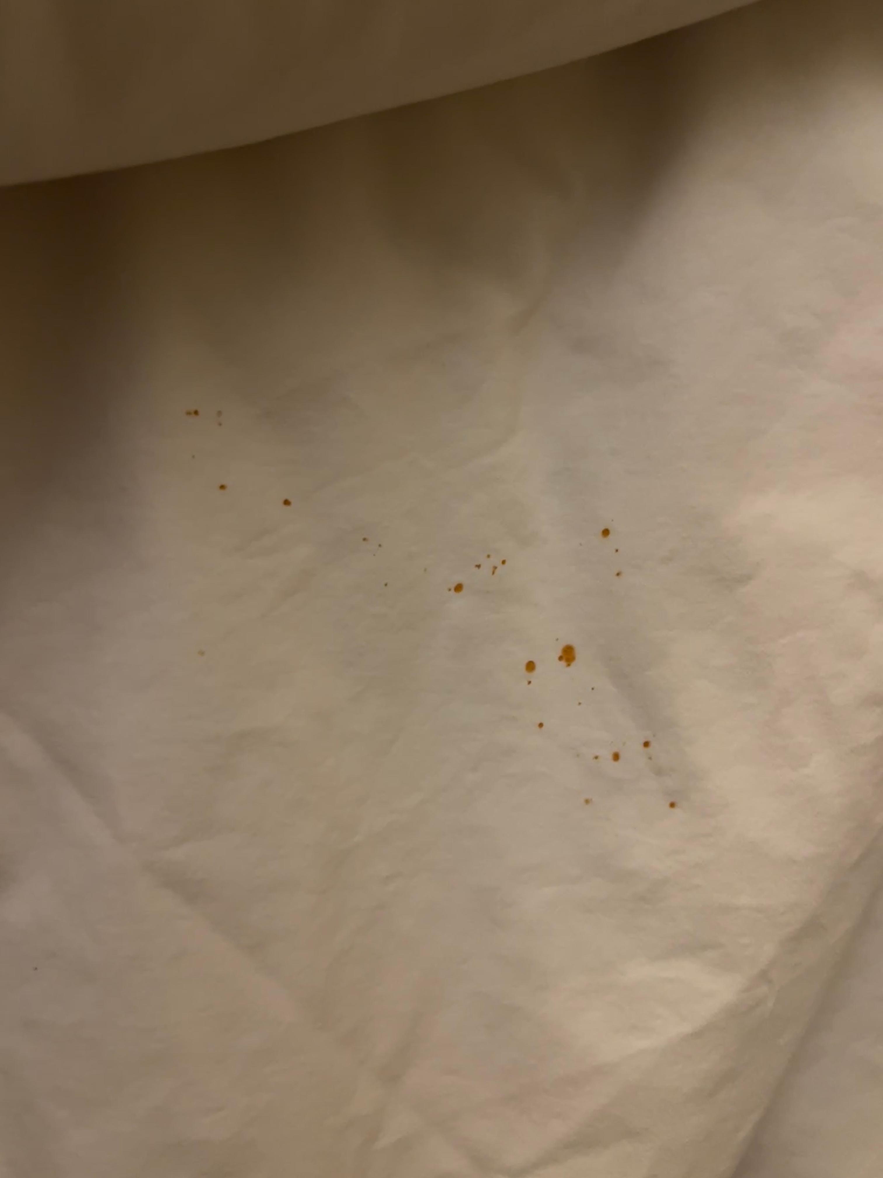 Blood stains on the sheets