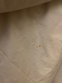 Blood stains on the sheets