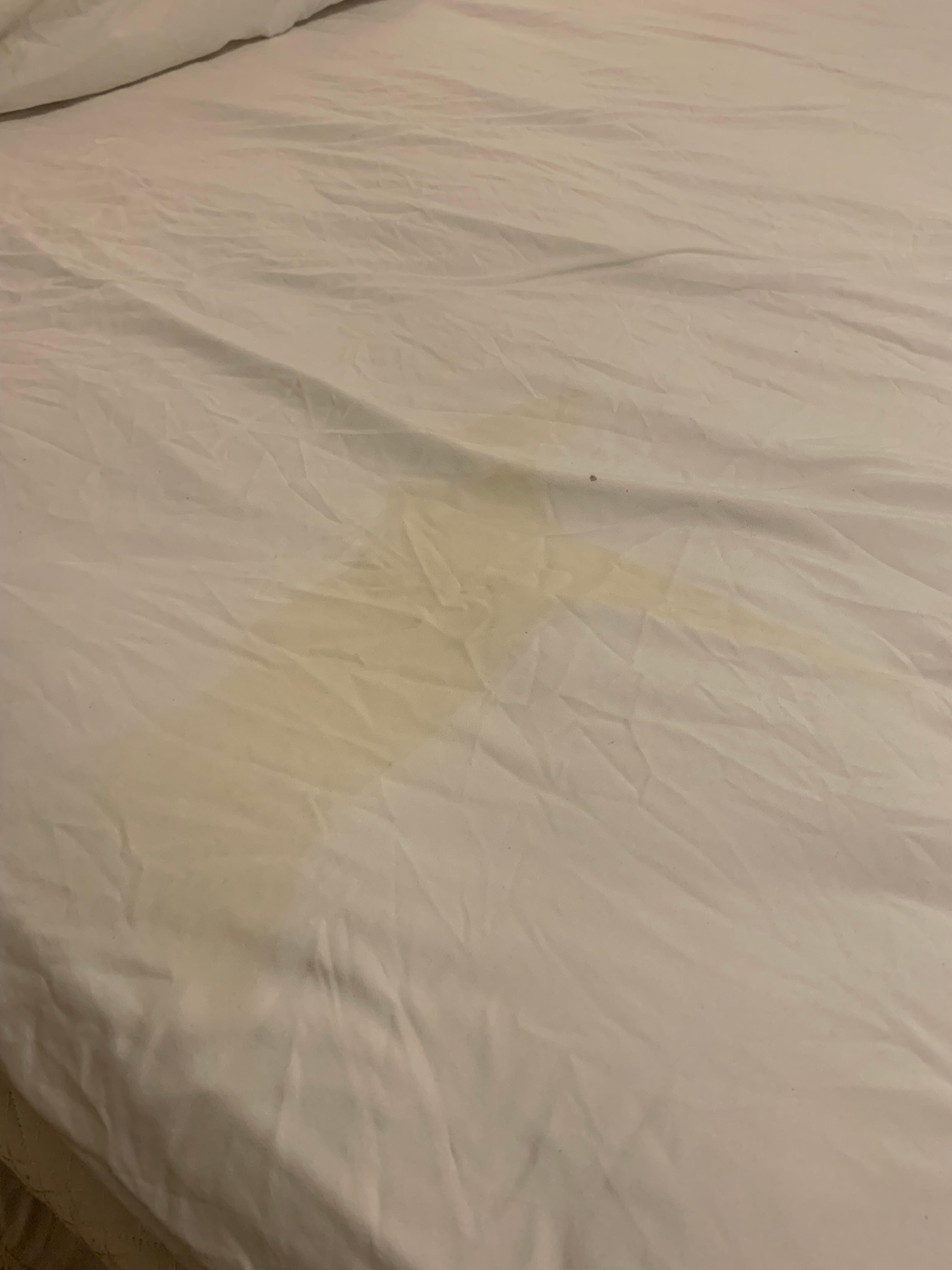 🤢