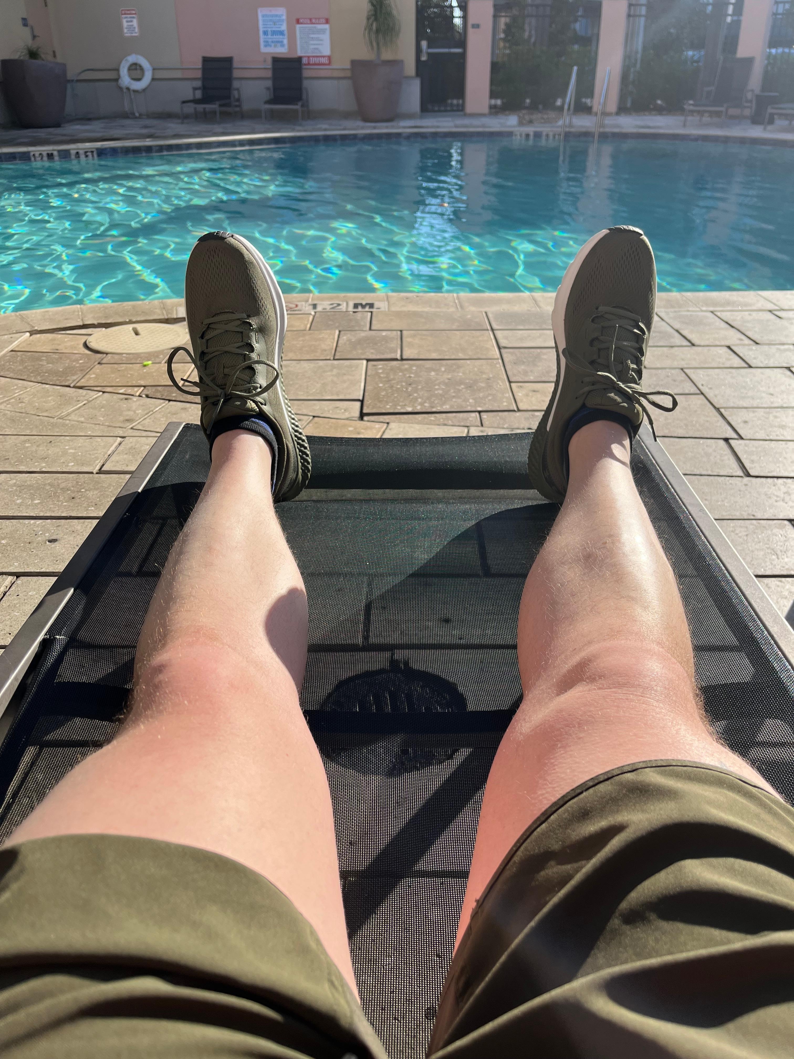 They’re slightly less pasty now, but not enough. Not the hotels fault