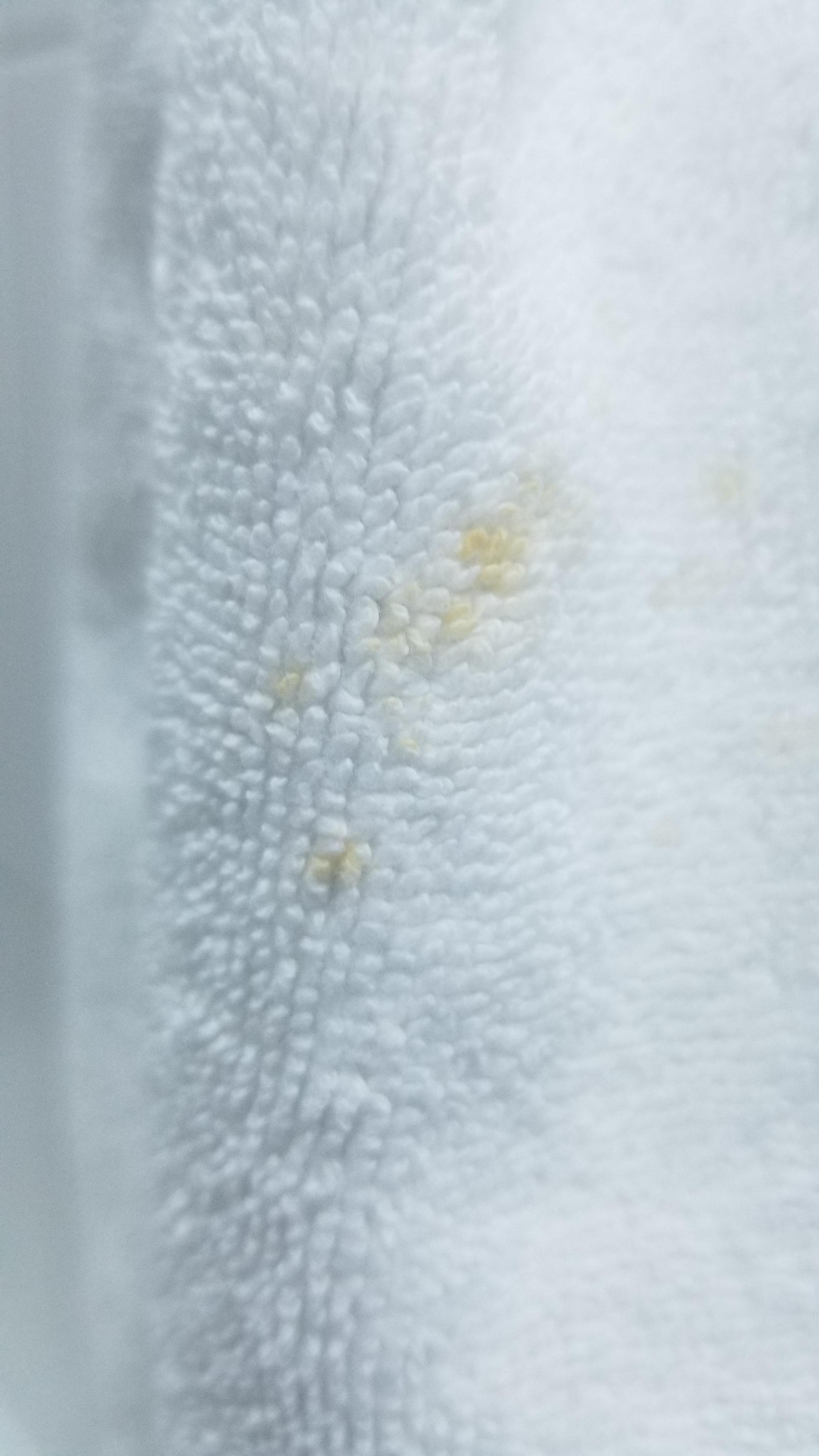 They provided white towels which were all stained and needed bleach or replacement 