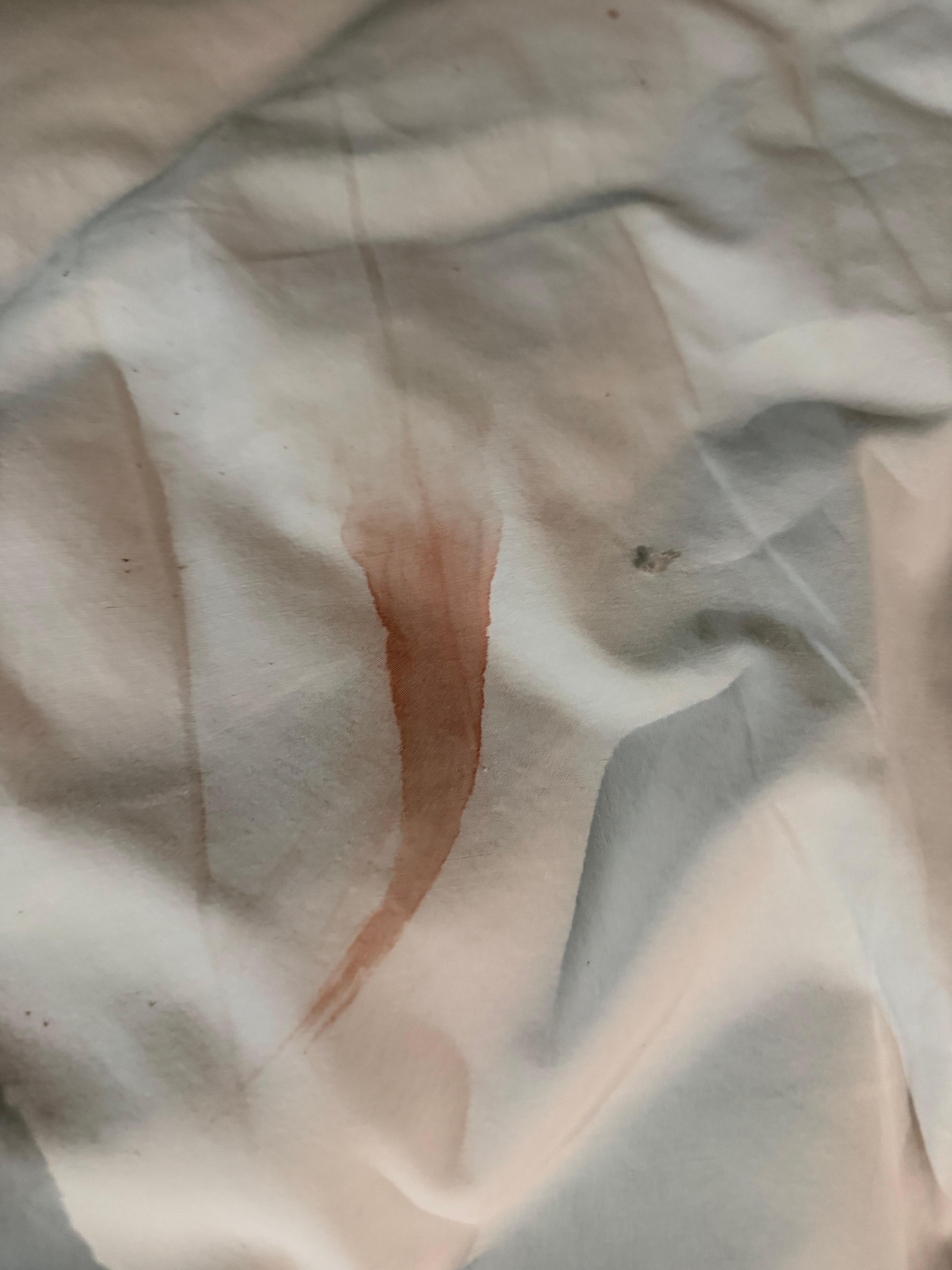 Blood on bed sheets