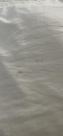 Blood on inside of quilt.