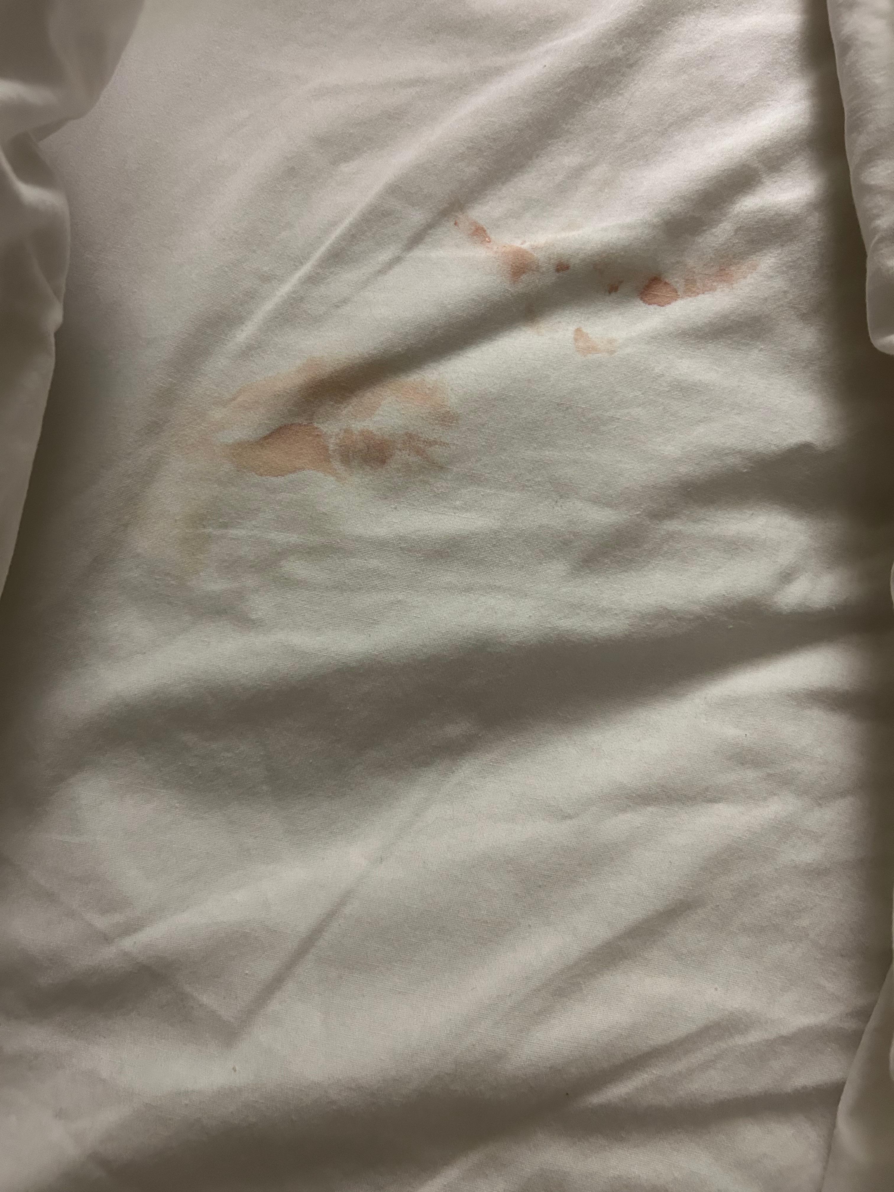 Allí está la mancha