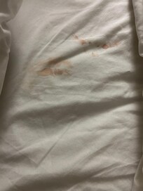 Allí está la mancha