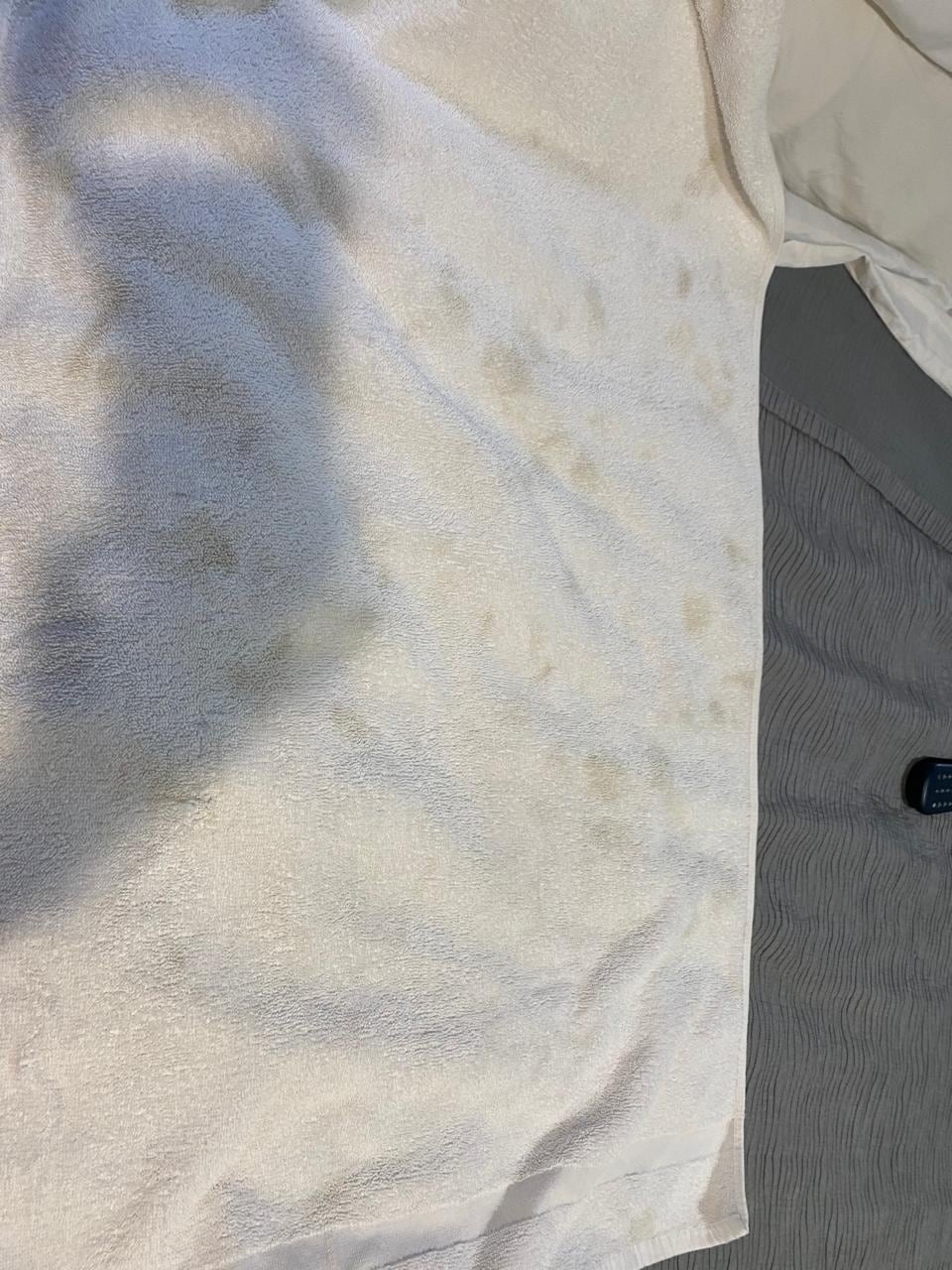 Las toallas llenas de hongo