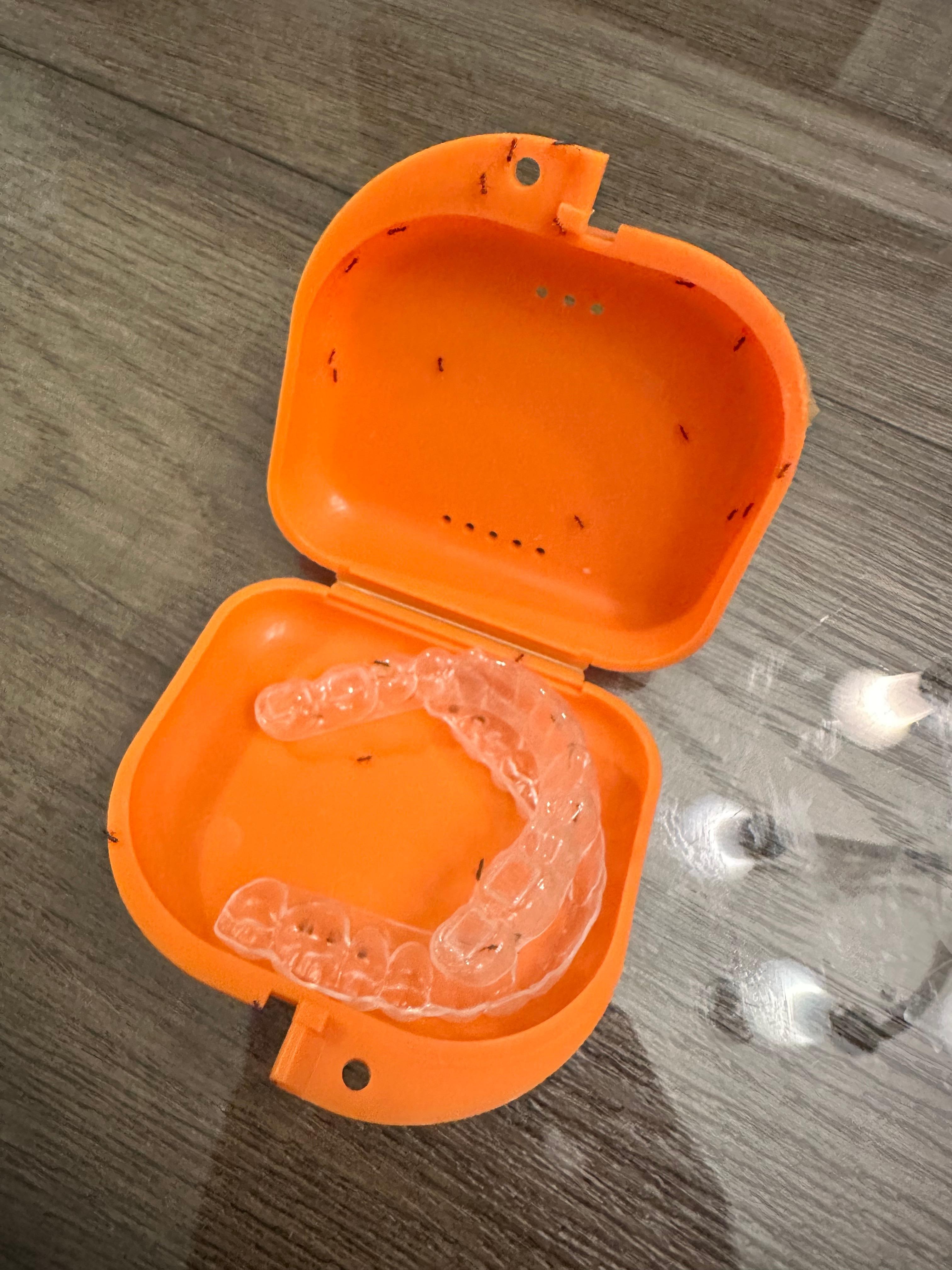 Ants in the retainer 