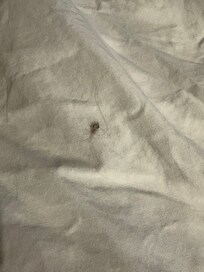 Hair on the bedsheet