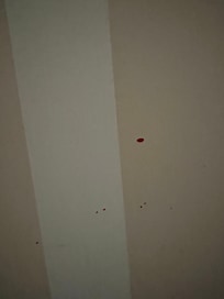 what appears to be blood