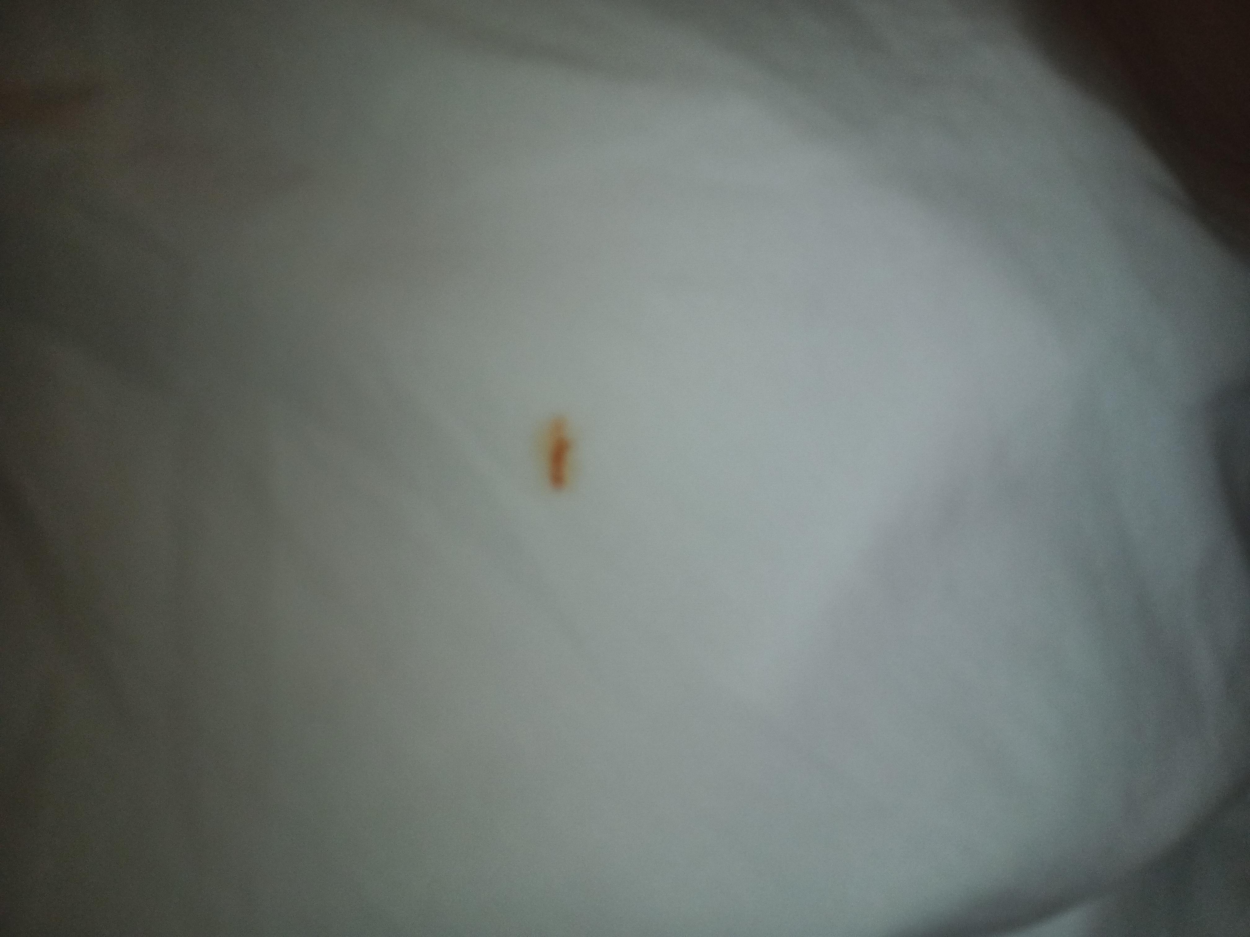 The blood spot that had been soaked through the entire bedding.