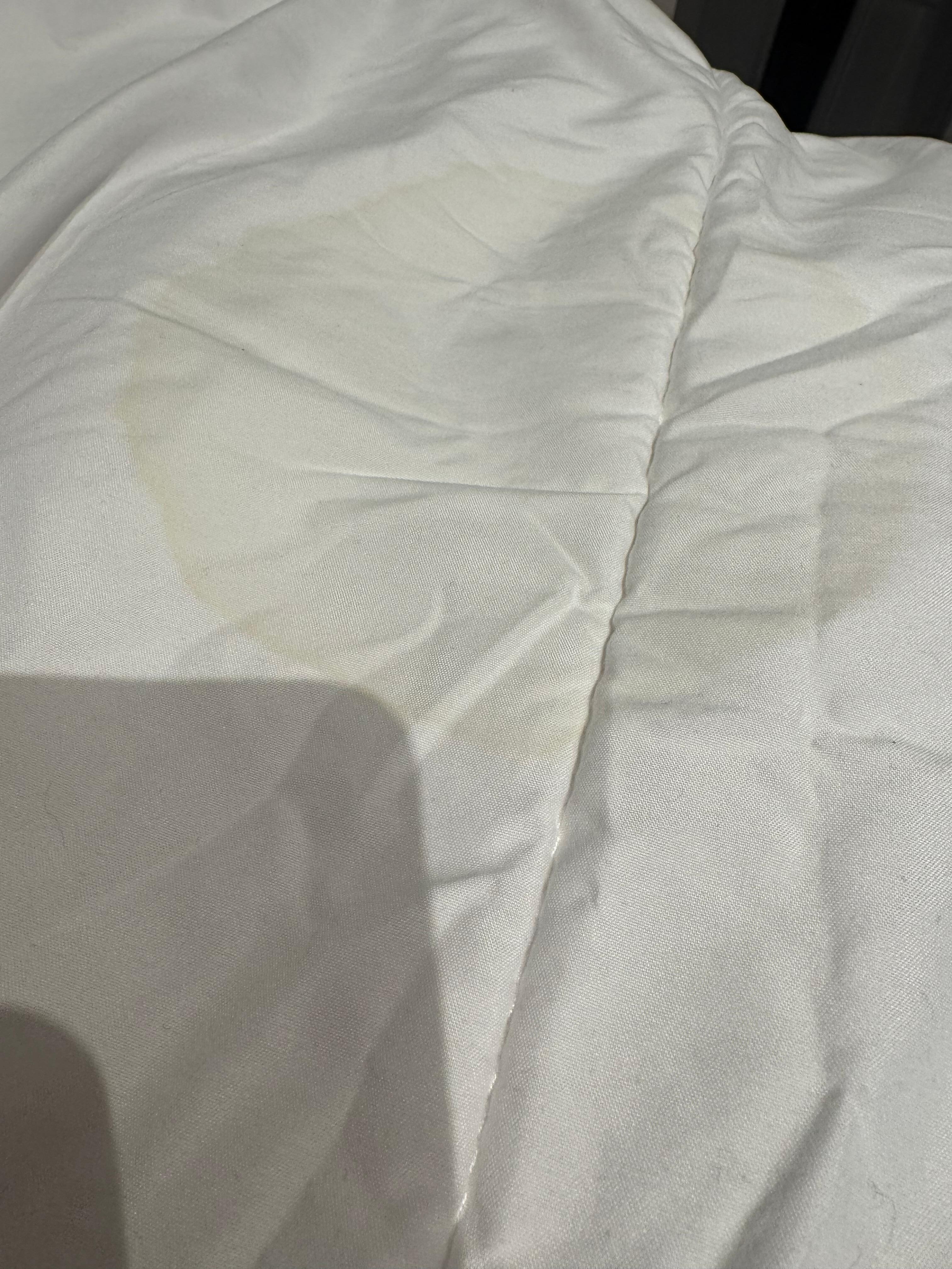 Yellow stains 