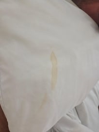 Stain on a pillow case
