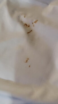 stained flat sheet stool or blood???