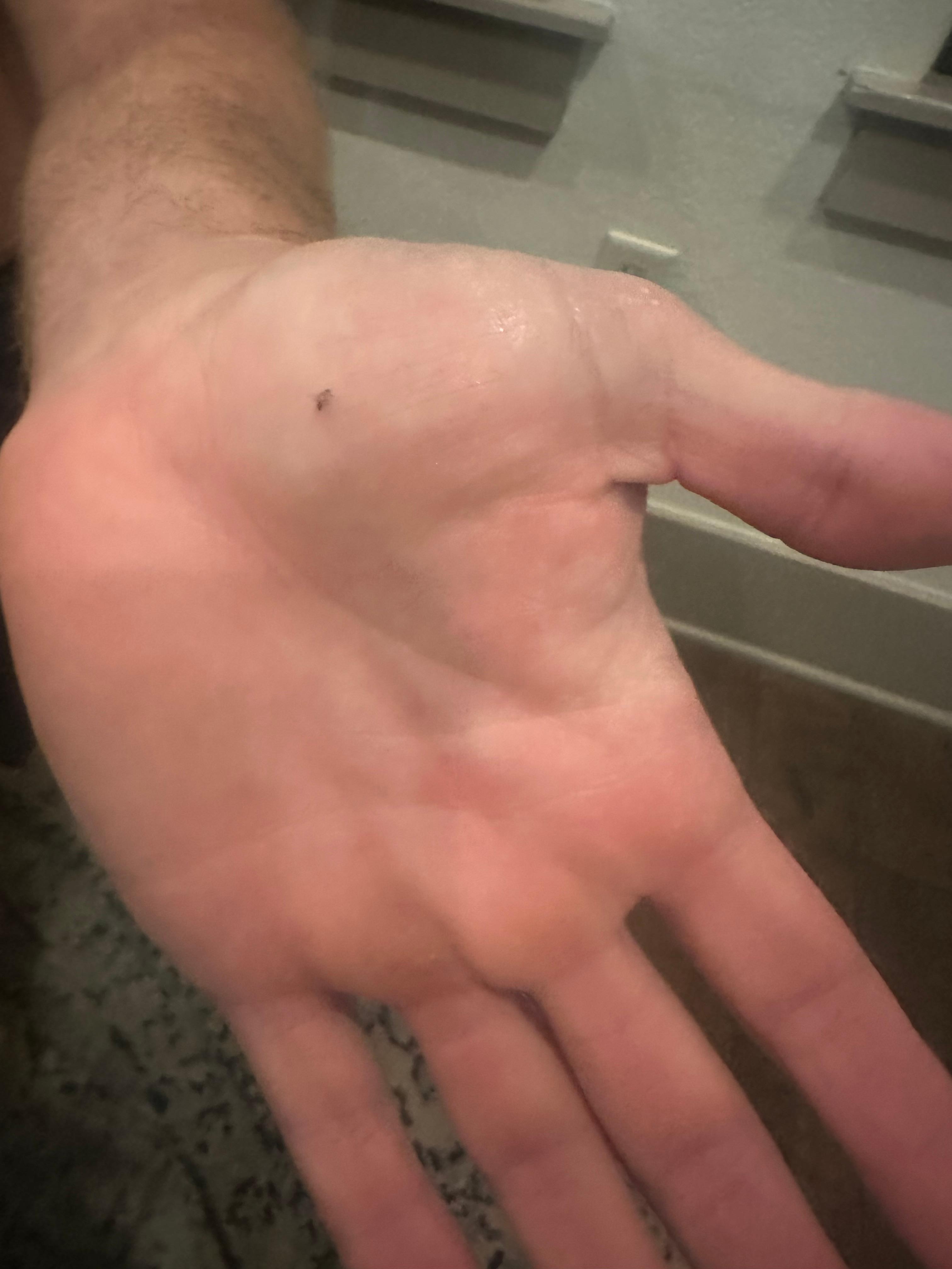 Landed on us while eating 