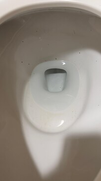 Specks of poop in the toilet
