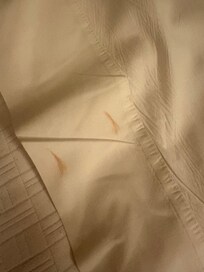 Red stains on the bed sheets.