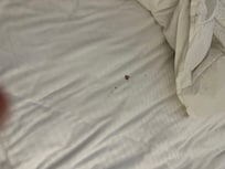 This was in the sheets I slept in and it did not come from me.