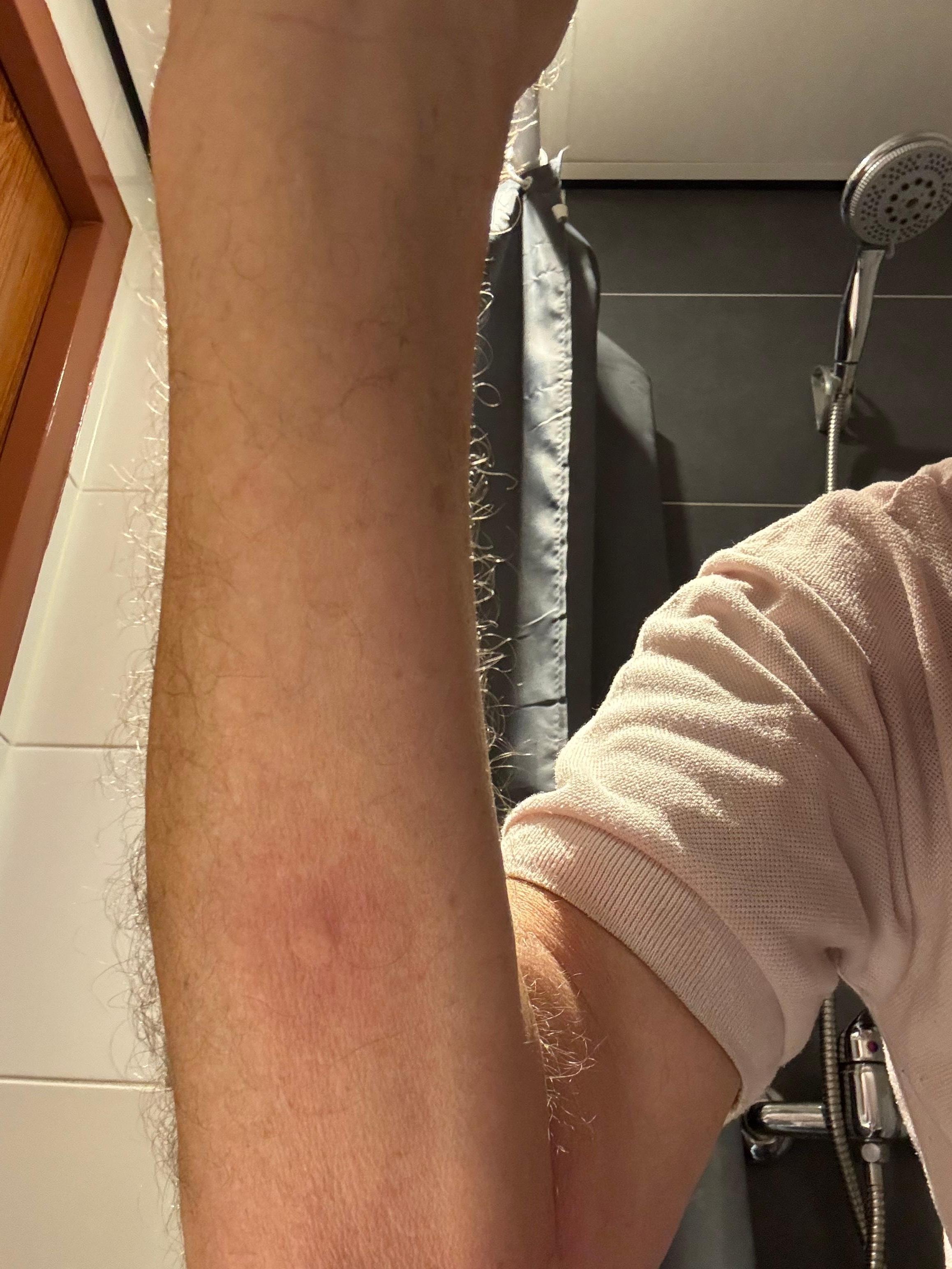 Many bed lice in one room 406