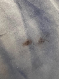 Blood on Bedsheets