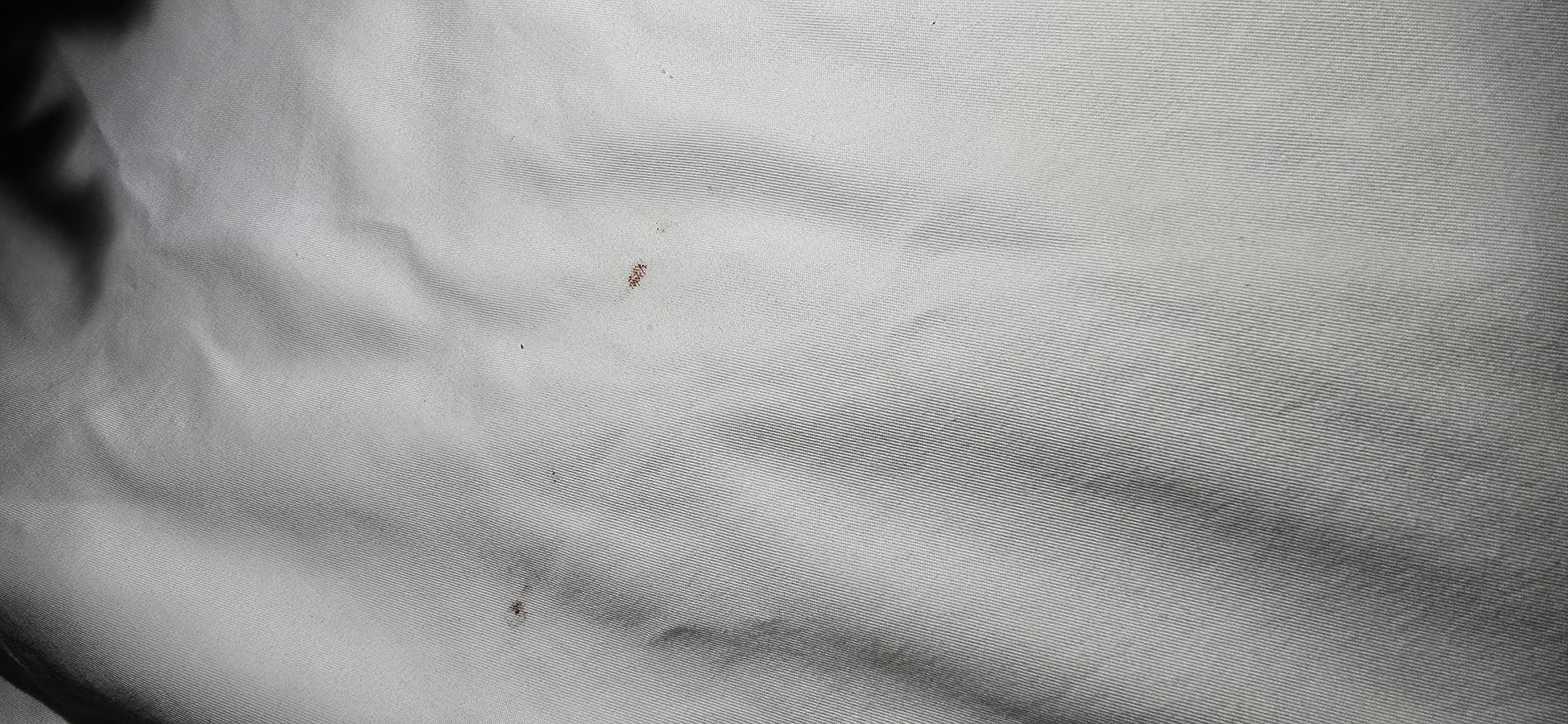 Dirty sheets. I wiped these "stains" off eith a baby wipe.
