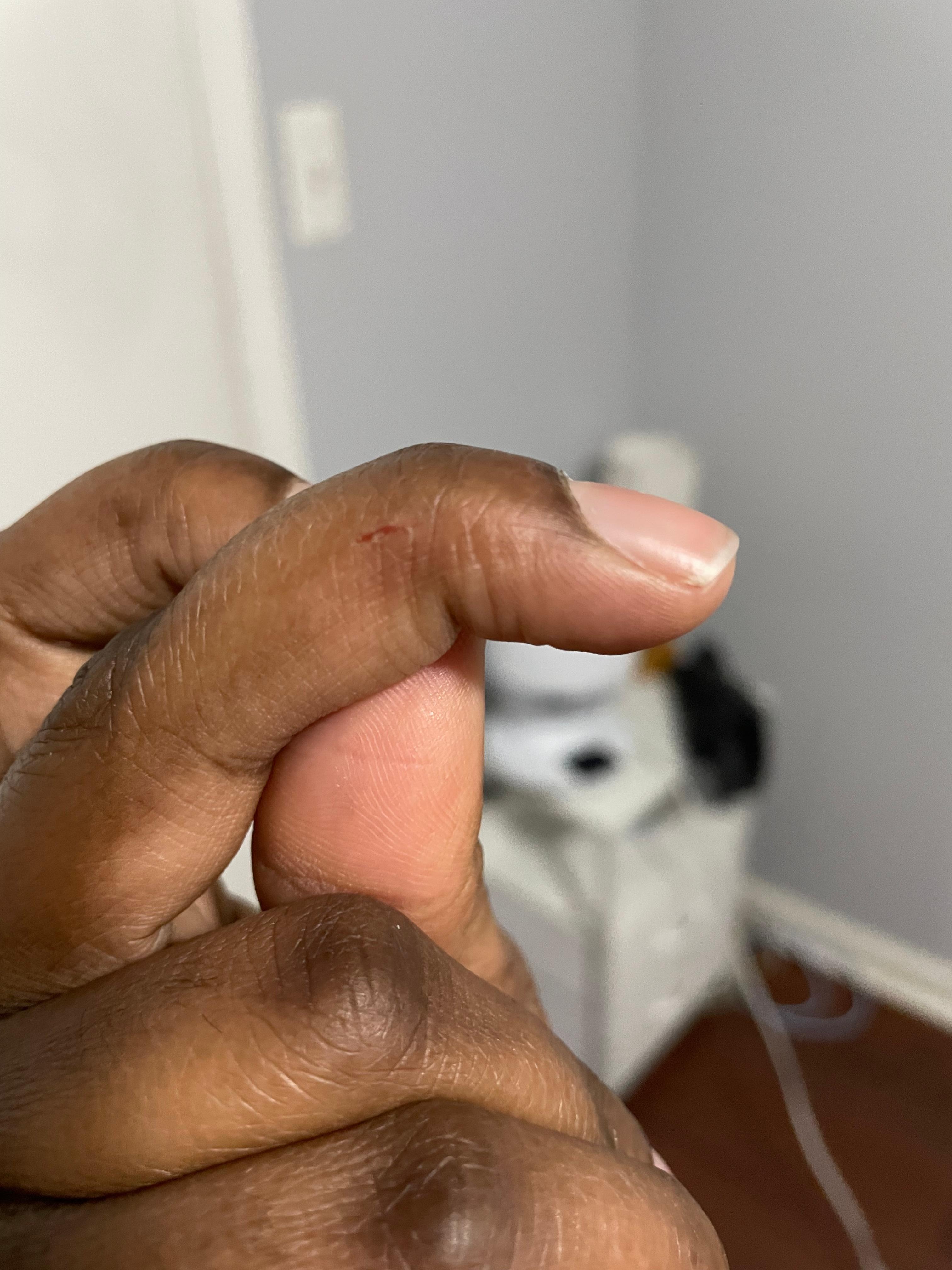 My daughter cut her finger on the knob the first day