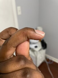 My daughter cut her finger on the knob the first day