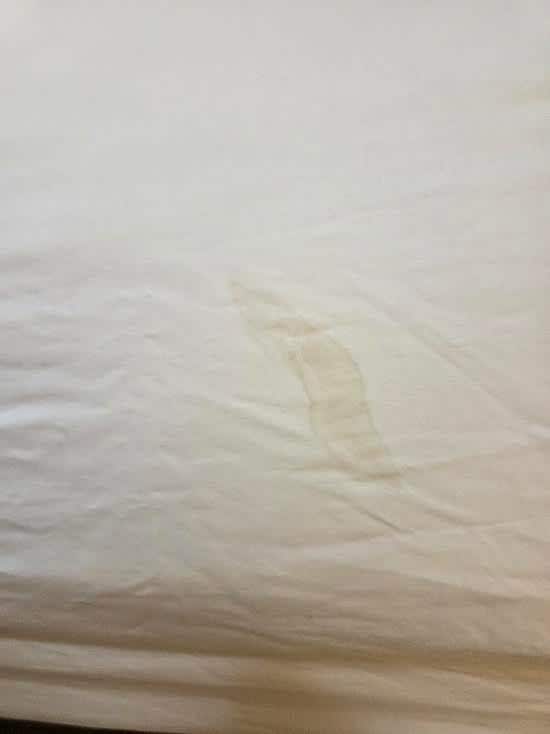 Yellow stain on sheet