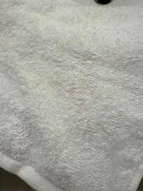 First place that was offered to us: Face cloth dirty
